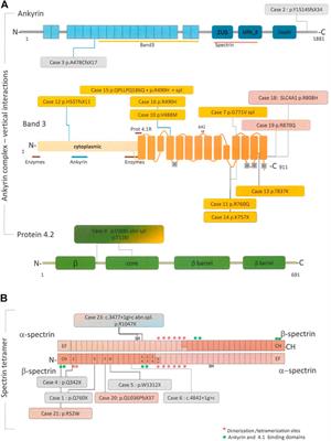 Effect of primary lesions in cytoskeleton proteins on red cell membrane stability in patients with hereditary spherocytosis